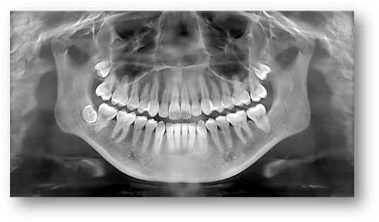 Image result for dental x ray
