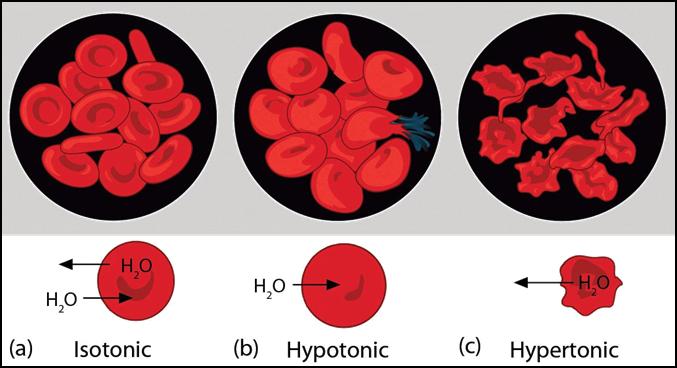 http://classconnection.s3.amazonaws.com/827/flashcards/762827/jpg/ball-fig11_0071347517345617.jpg