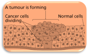 http://drfadi.org/bilder/cancerform.png